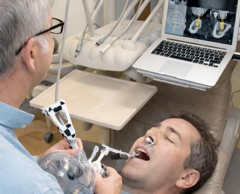 X-Guide® : chirurgie implantaire ultra-précise – We Smile