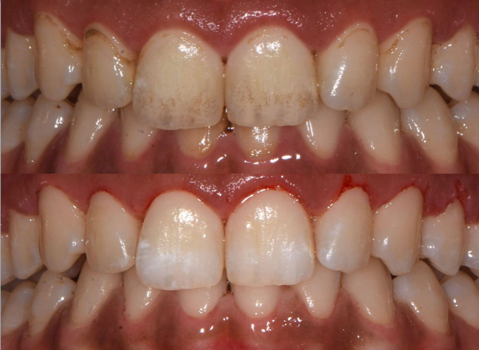 hygiène-bucco-dentaire-wesmile2